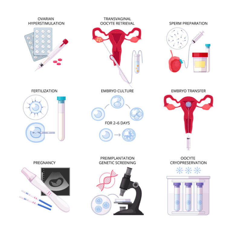 What Are The 5 Stages Of IVF A Complete Guide