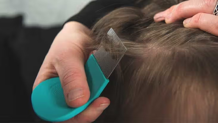 Treat Head Lice at Home
